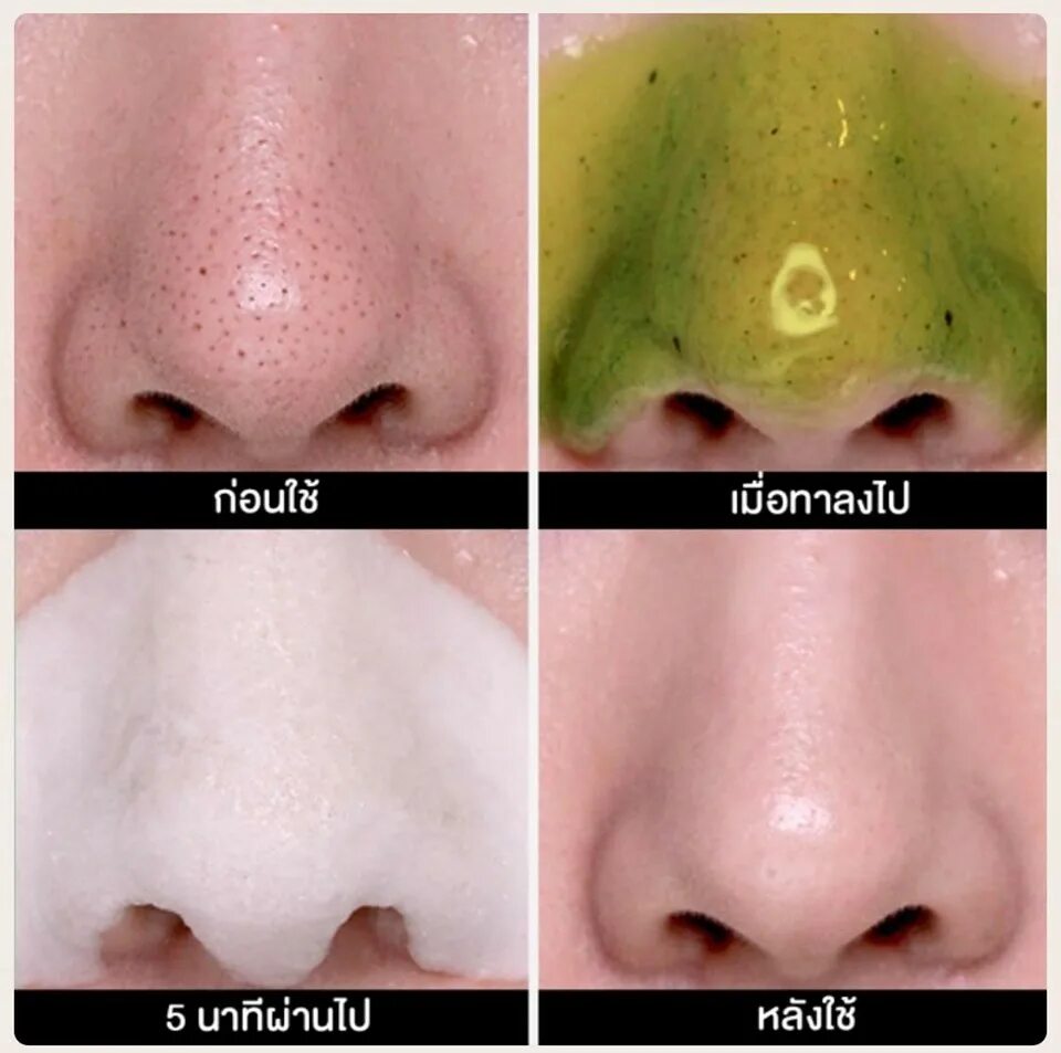 B project bye blackhead melting remover. Some by mi Bye Bye Blackhead 30 Days Miracle Green Tea Tox Bubble Cleanser. Some by mi Bye Bye Blackhead. Bye Bye Blackhead от черных точек. Маска пузырьковая сам бай ми.