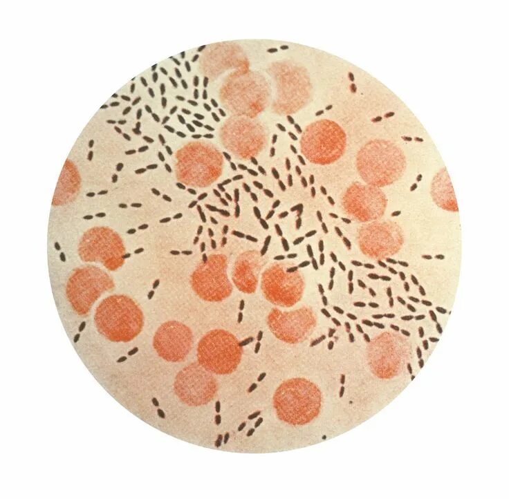 Streptococcus pneumoniae haemophilus influenzae streptococcus. Стрептококк пневмония под микроскопом. streptococcus pneumoniae под микроскопом. стрептококки пневмококки.