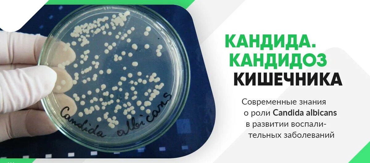 Что такое грибковая инфекция Candida. Системная терапия кандидоза.