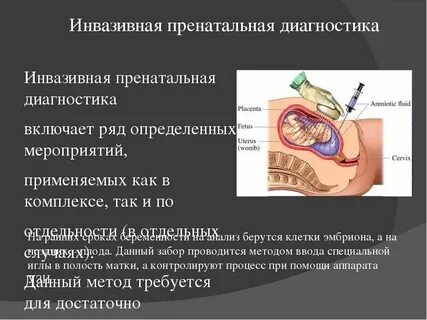 Инвазивная диагностическая процедура