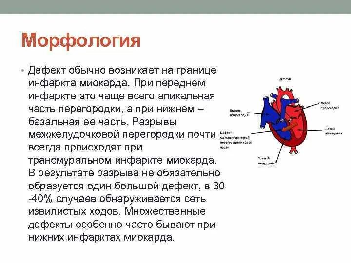 Обширный инфаркт межжелудочковой перегородки. Эхокг при инфаркте миокарда. Аневризма межжелудочковой перегородки эхокг. Аневризма верхушки эхокардиография. Разрыв межжелудочковой перегородки.