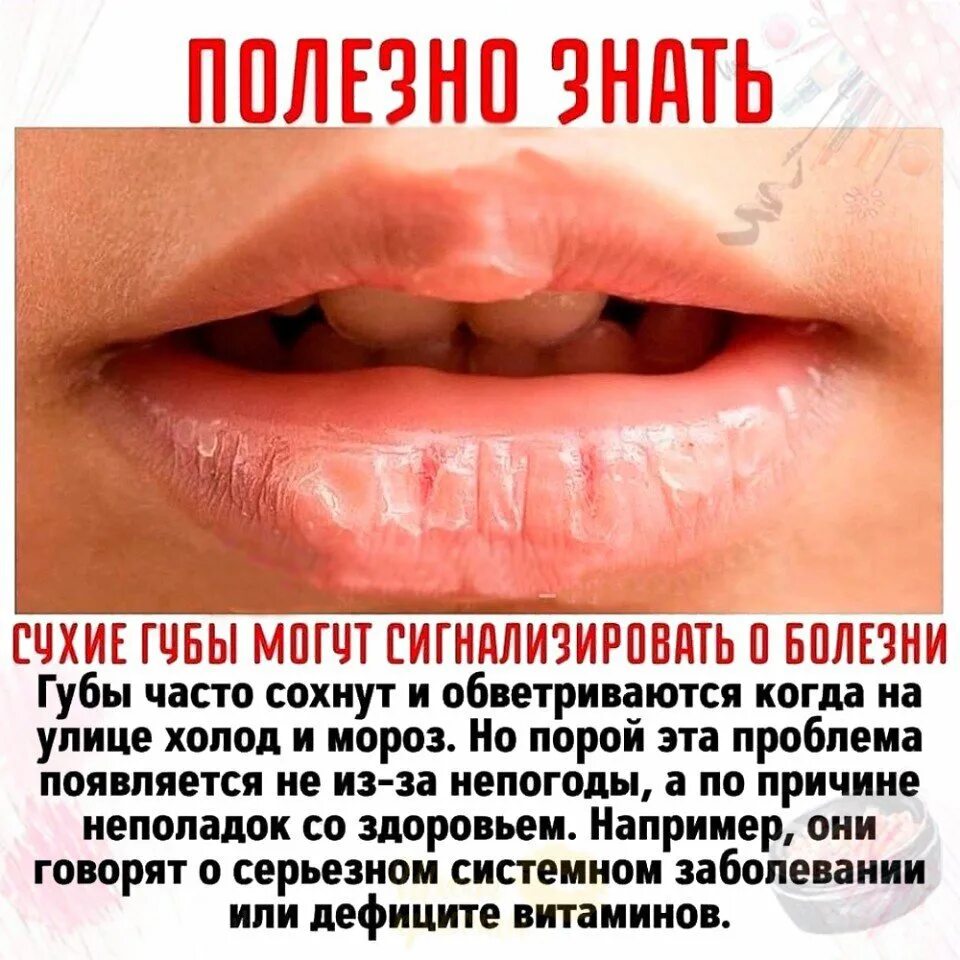 Почему утром губы