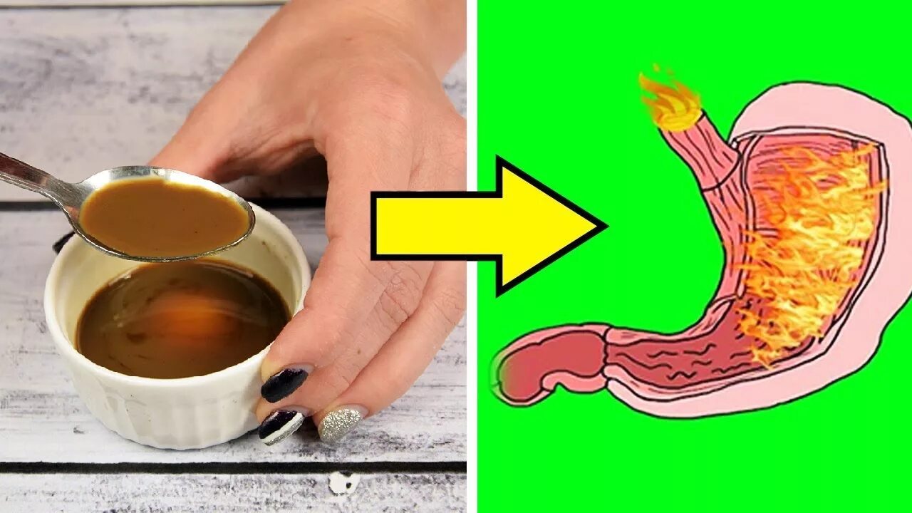 Подручные средства от изжоги. От каких продуктов бывает изжога список. Как пить соду при изжоге. Чем убрать изжогу без соды. Чем убрать изжогу без соды.