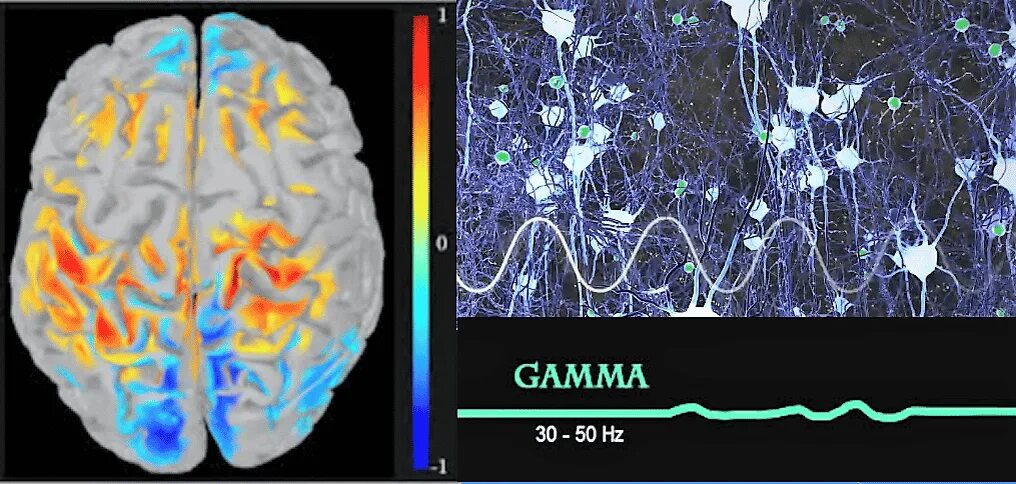 Альфа бета гамма волны головного мозга. Ритмы мозга Альфа бета тета Дельта ритмы. Гамма ритм ЭЭГ. Бета ритм головного мозга. Мозг альфа бета