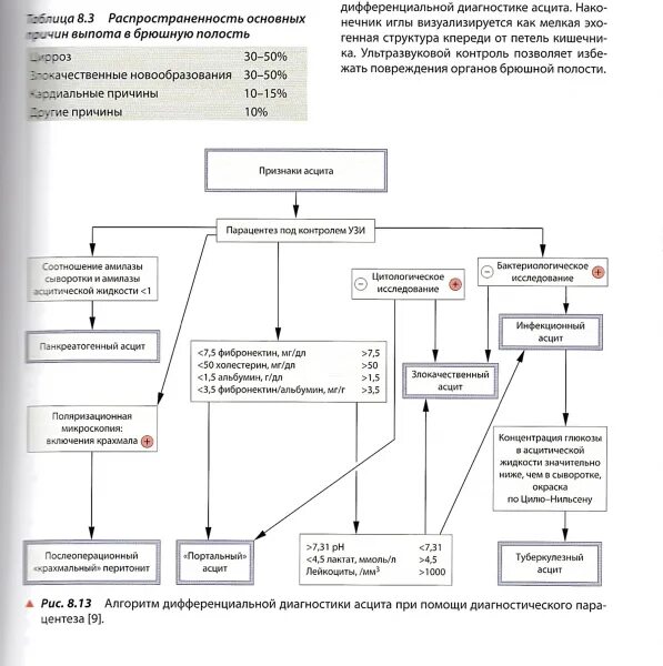 Синдром асцита. Алгоритм диагностики асцита. Отечно-асцитический синдром дифференциальная диагностика. Дифференциальный диагноз асцита. Дифференциально-диагностический алгоритм.