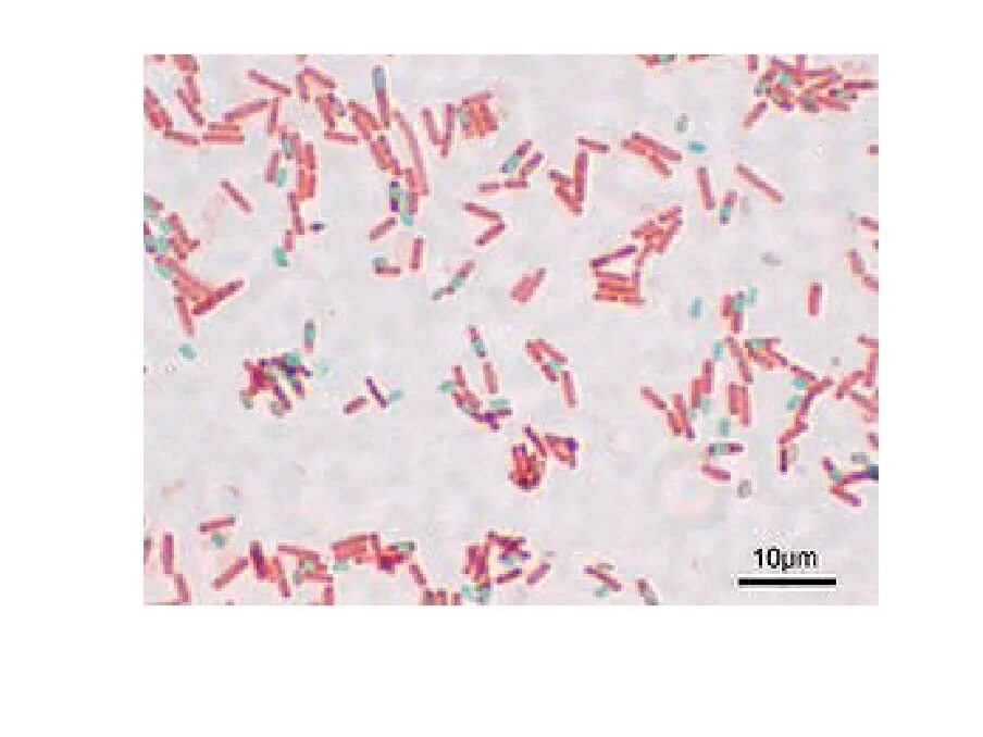 Ожешко микробиология. Bacillus subtilis окраска по ожешко. bacillus окраска ожешко. окраска ожешко bacillus cereus. bacillus cereus окраска по ожешко.