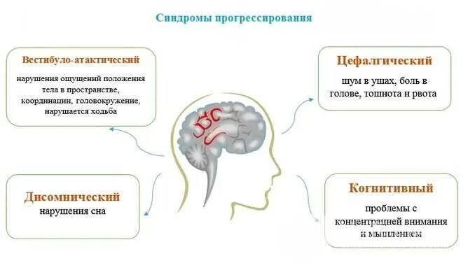 2 Стадия дисциркуляторной энцефалопатии. Дисциркуляторная энцефалопатия головного мозга 2 степени. Энцефалопатия головного мозга что это такое. Синдром энцефалопатии.