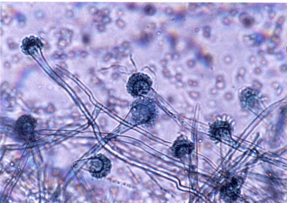 Патогенные грибы споры. Глубокие микозы микроскопия. Микроскопия грибковых заболеваний. Антропофильные дерматофиты.