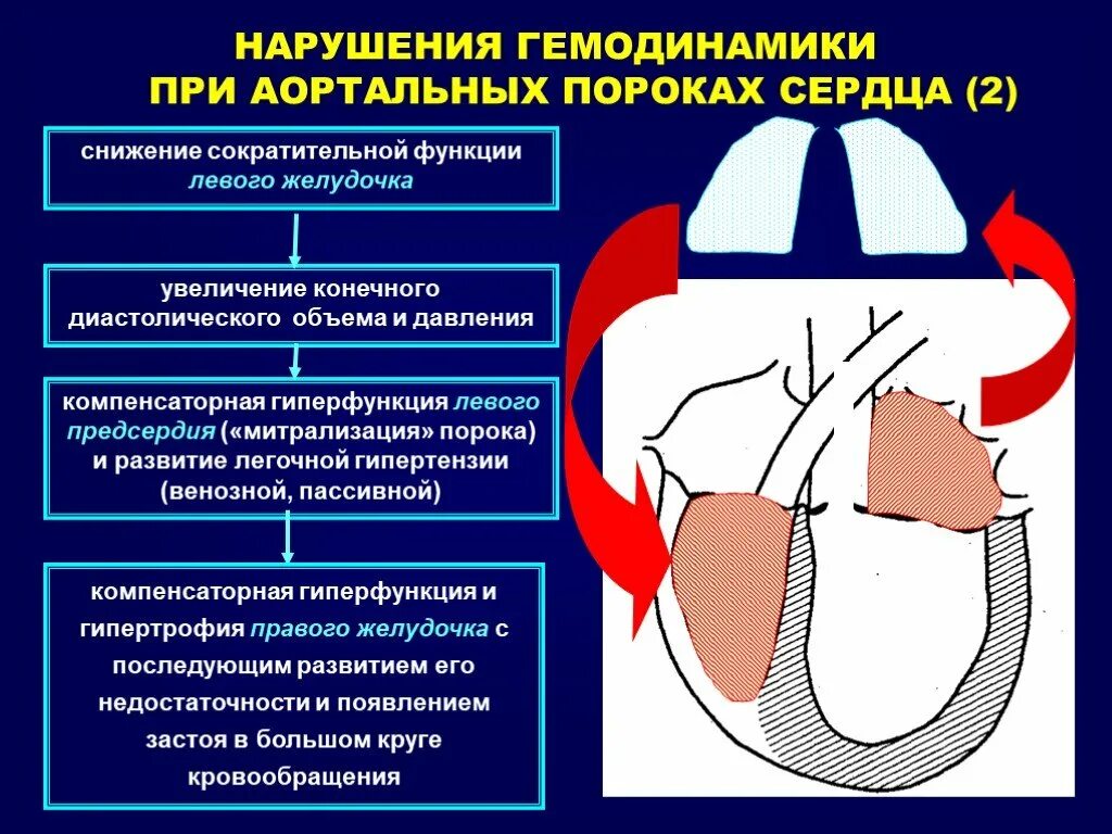 Недостаточность предсердия. Нарушение гемодинамики при пороках сердца. Аортальный стеноз гемодинамика схема. Приобретенные пороки сердца схема гемодинамики. Гемодинамика при пороках аортальных пороках сердца.