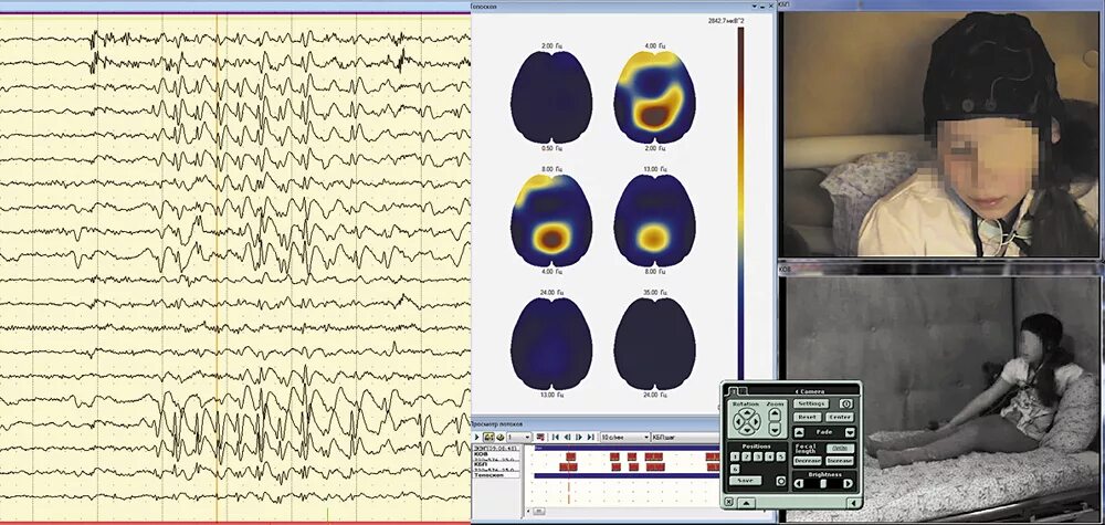 Ээг ребенку платно. Энцефалограмма головного мозга. ЭЭГ мониторинг головного мозга. ЭЭГ ночной сон видеомониторинг. ЭЭГ (электроэнцефалограмма) головного мозга.