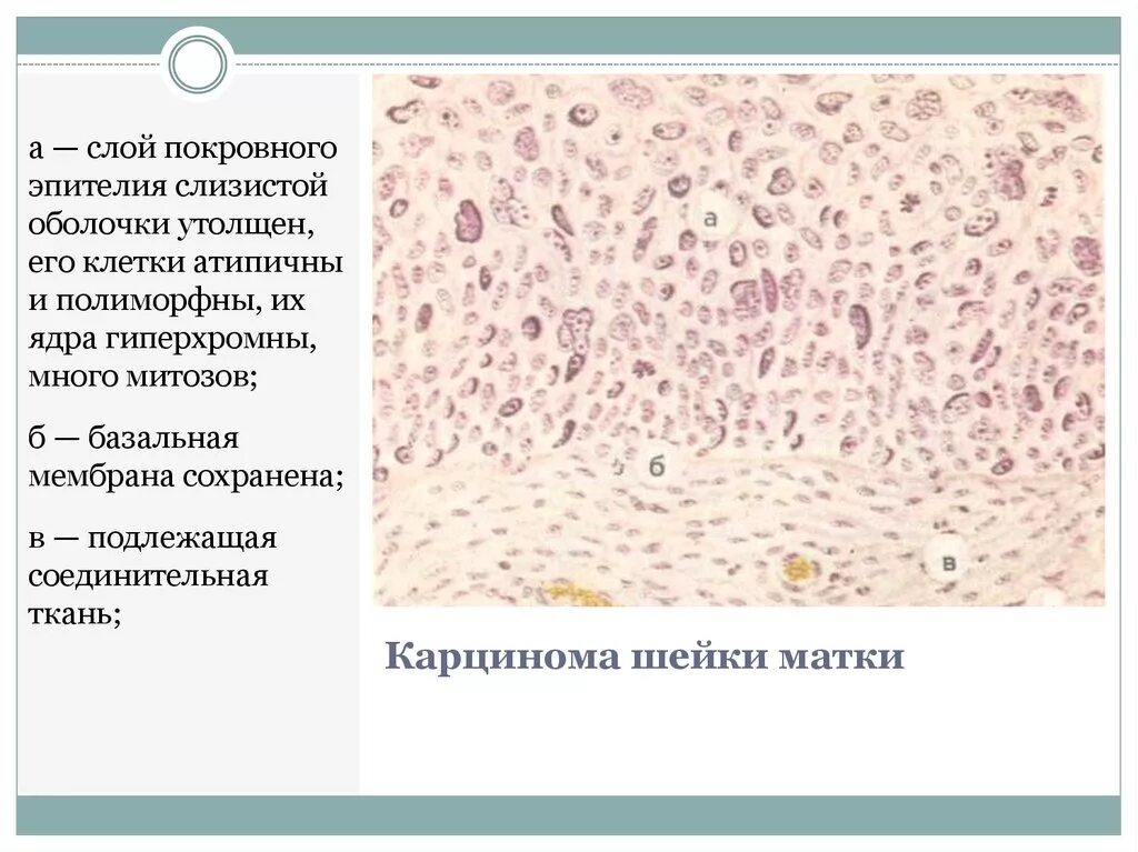 Реснитчатый эпителий гистология препарат. Метаплазированный эпителий с реактивными изменениями что это. Мерцательный эпителий микропрепарат. Однослойный многорядный призматический эпителий. Мерцательный эпителий микропрепарат.