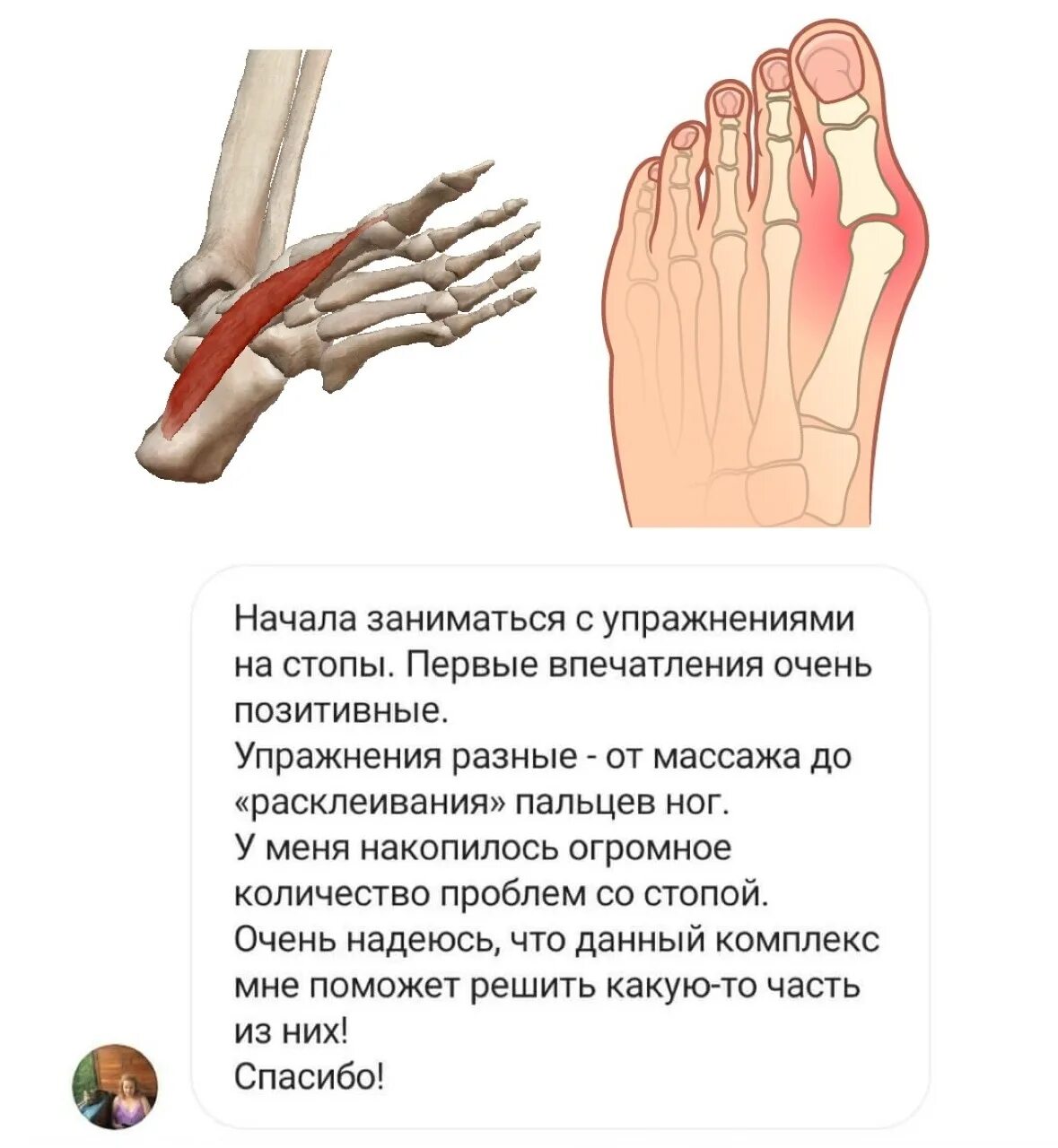 Ноги