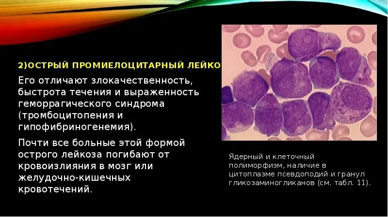 Острый промиелоцитарный лейкоз классификация. Промиелоцитарный лейкоз синдромы. Острый промиелоцитарный лейкоз клиника. Острый промиелоцитарный лейкоз патогенез.