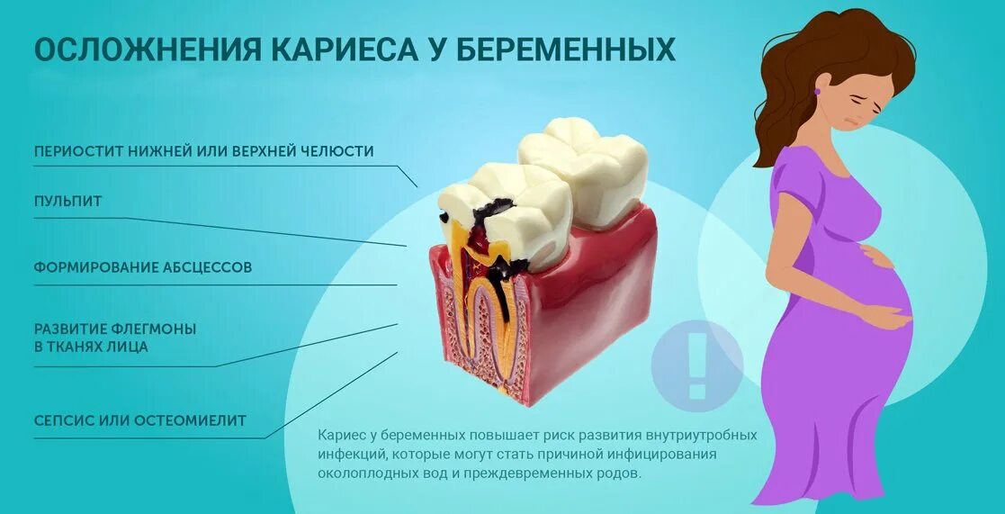 Зубная боль при беременности форум. Кариес при беременности. профилактика кариеса у беременных. профилактика кариеса зубов у беременных.