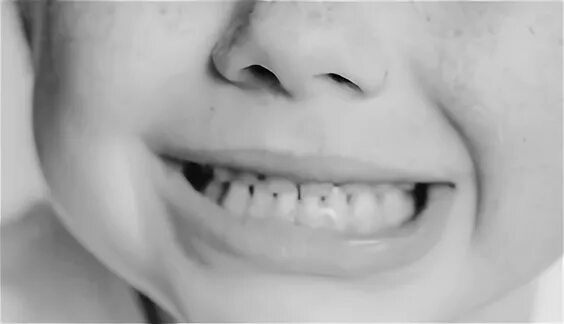 Ребенок год скрежет зубами. Ребёнок 2 года скрипит зубами.