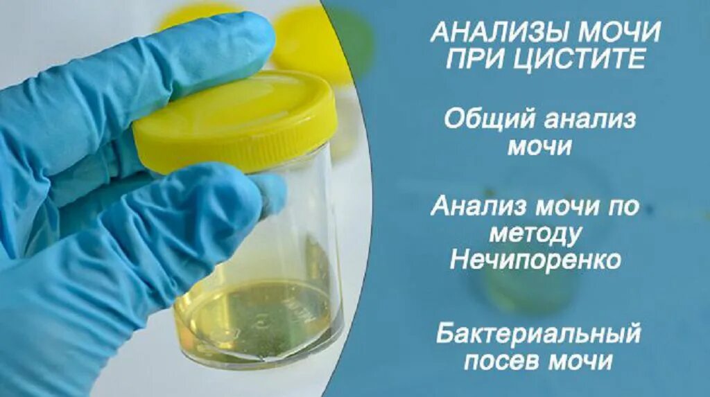 Желтая моча при цистите. Моча при цистите. лабораторные исследования мочи. исследование мочи нечипоренко. анализ мочи при цистите.
