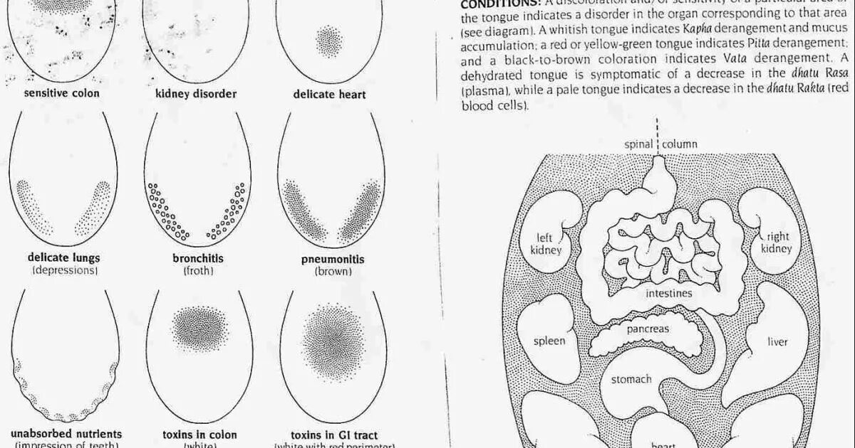 Как определить больной орган. Диагностика заболеваний по языку. Заболевания органов по языку. Распознавание болезни по языку. Распознать болезнь по языку.