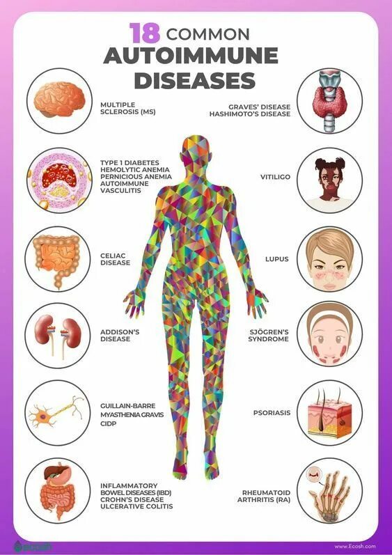 Autoimmune disorders, including lupus and rheumatoid arthritis. Витилиго это аутоиммунное. Autoimmune disease. Autoimmune diseases causes. Аутоиммунные заболевания кожи.