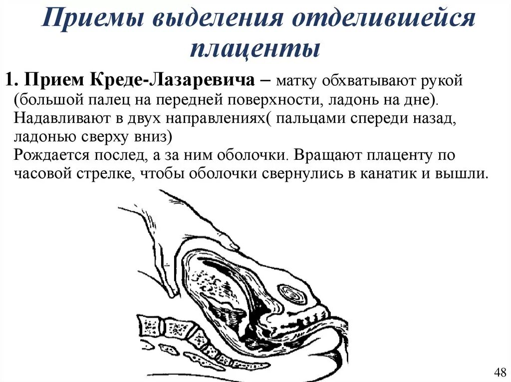 Массаж матки после родов. Методы выделения отделившегося последа Креде Лазаревич. Методы выделения последа Абуладзе. Приемы Абуладзе, Гентера, Креде-Лазаревича. Способы выделения последа (Абуладзе, Креде-Лазаревича, Гентера).