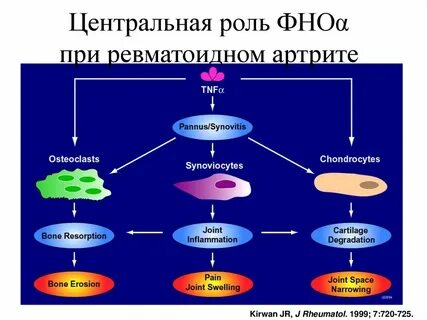 Ревматоидный артрит иммунный