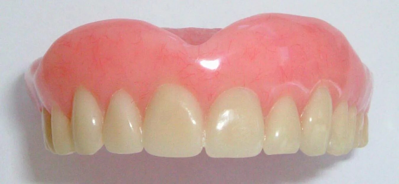 частичные протезы без неба. нейлоновый протез зубов. частичные протезы без неба.