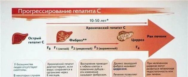 Гепатит с у женщины как передается. Внешние проявления гепатита с. Гепатит б симптомы у мужчин.