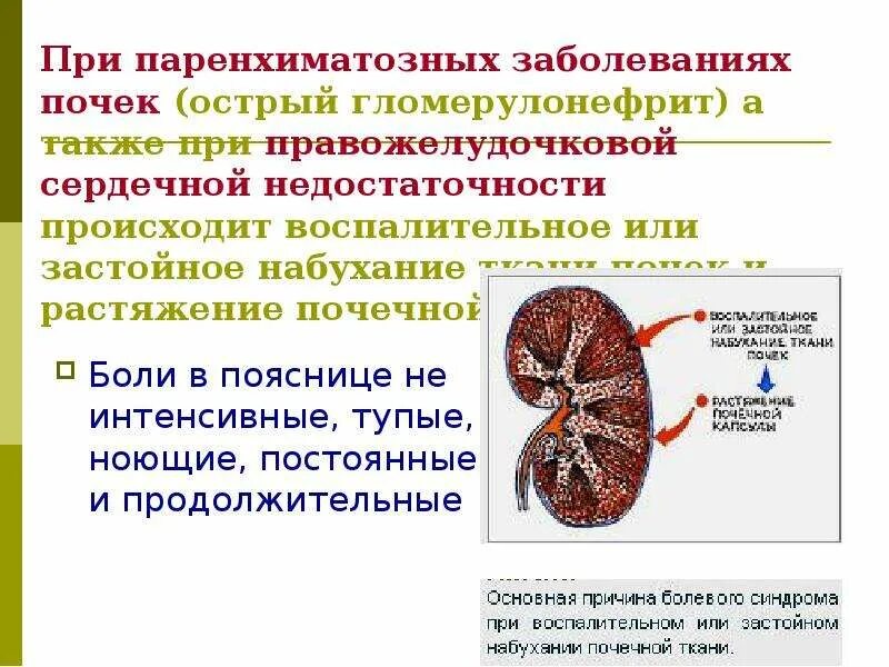 Заболевание почек конспект. Почка при остром гломерулонефрите. Паренхиматозные заболевания почек. Вид почки при остром гломерулонефрите.