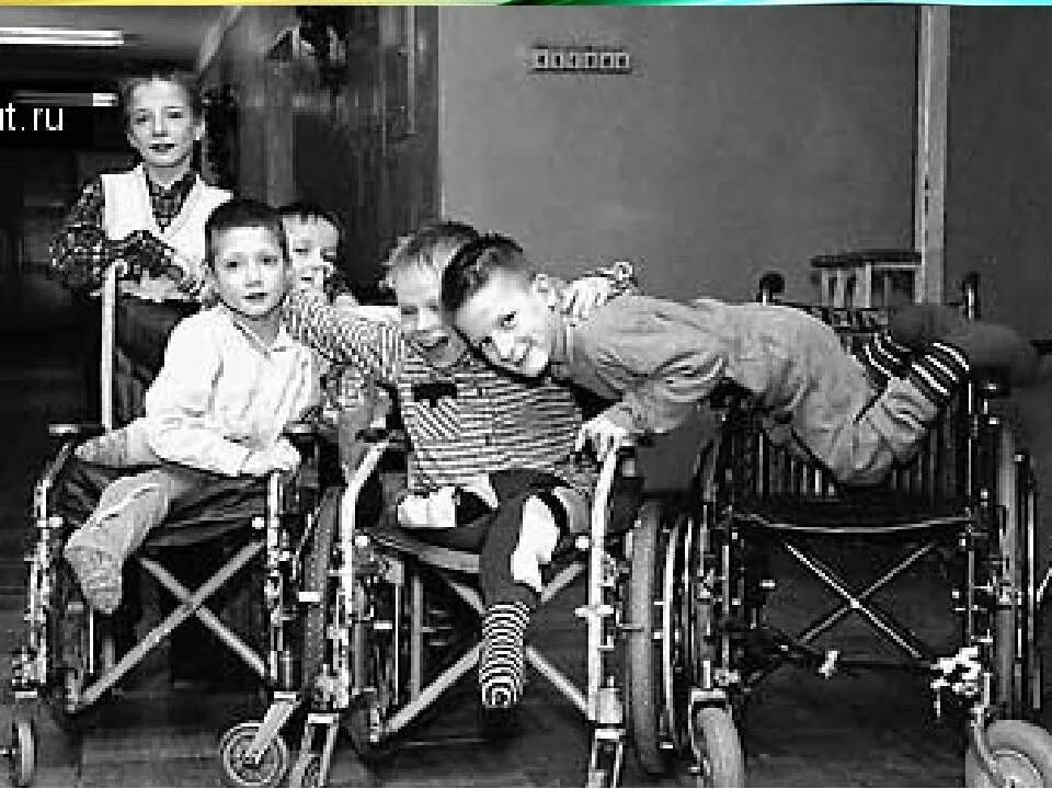Дцп история. Дети инвалиды. Дети инвалиды ДЦП. Советские дети инвалиды. Дети с ДЦП фото.