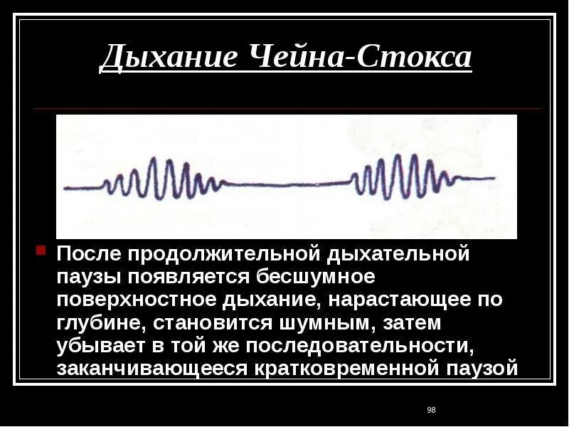 1 редкое дыхание. Дыхание типа Чейна-Стокса. Механизм дыхания Чейна Стокса. Типы дыхания Куссмауля Чейна Стокса Биота. Дыхание по типу Чейна Стокса.