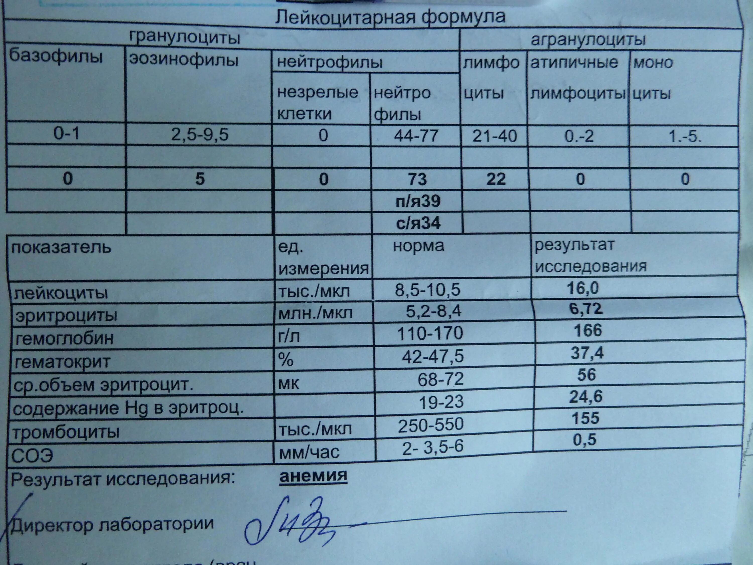 Исследование крови лошади норма. Забор крови у крс на лейкоз и бруцеллез. Показатели в биохимическом анализе крови у лошади. Показатели кровь биохимия лошади в норме. Анализ лошадей.
