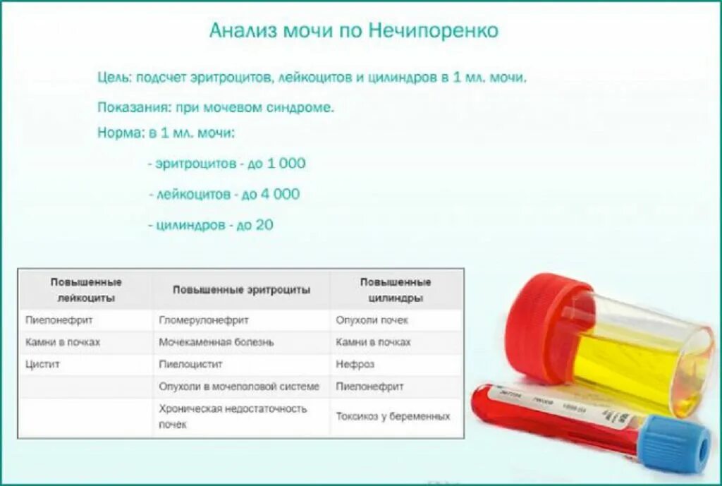 Сколько мочи нужно для общего анализа взрослого. Хранение мочи для анализа. Анализ мочи. Годность мочи для исследования. Сколько хранится моча для анализа.