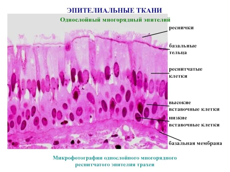 Какую функцию выполняет мерцательный эпителий. Мерцательный эпителий гистология. клетки многорядный цилиндрический реснитчатый эпителия. однослойный мерцательный эпителий. многорядный призматический мерцательный эпителий.