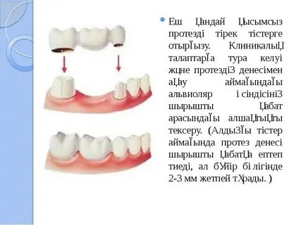 Бүкіл қыздық перденің жақыннан түсірілген фотосы