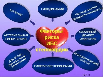 Гиподинамия относится к факторам риска