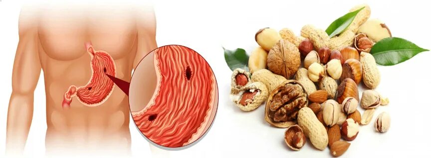 Ореховая смесь (фундук, миндаль, грецкий, курага, чернослив, финики). Орехи при жкт. Разные орешки. Грецкий от грецкого ореха бывает запор. Ляб ляби.