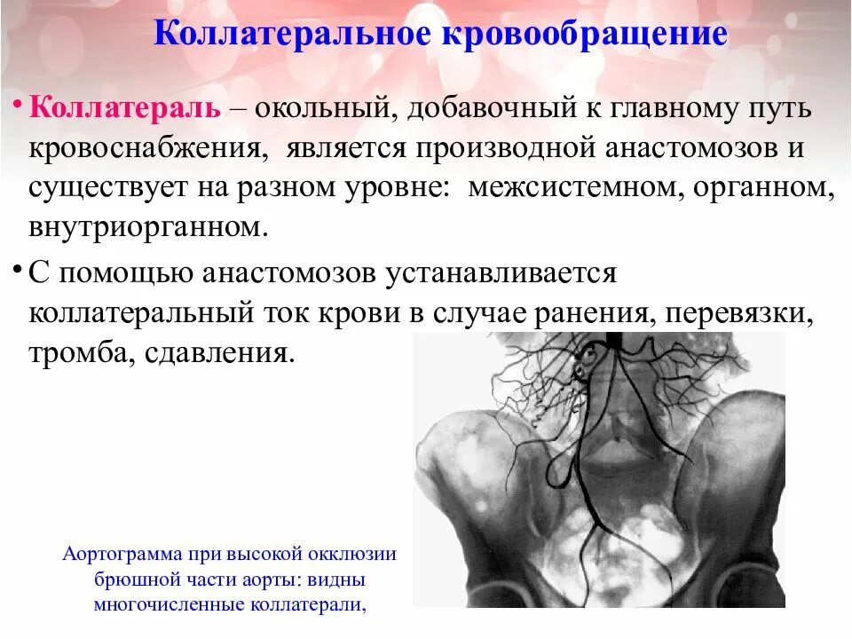 Коллатеральное кровообращение. Коллатеральное (Окольное) кровообращение. Пути коллатерального кровотока. Пути коллатерального кровообращения.