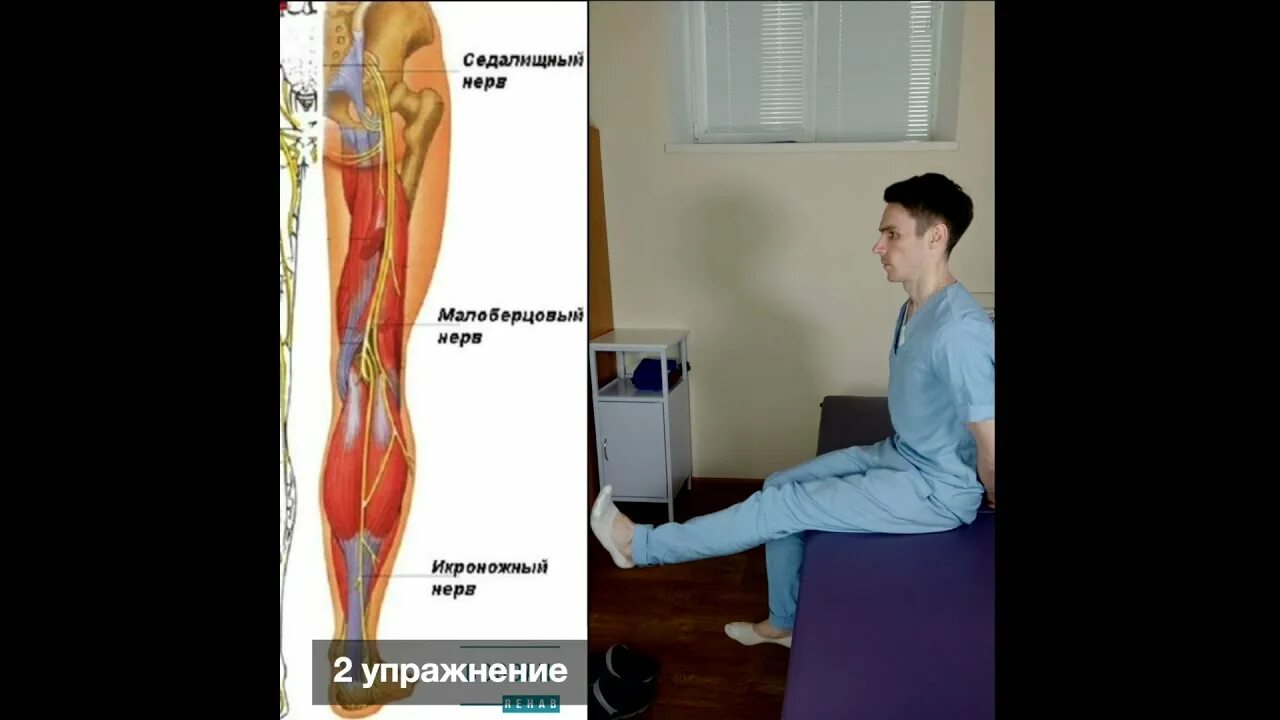 Что будет если попасть в седалищный нерв. Туннельный синдром седалищного нерва. Седалищный нерв картинка. Как проходит седалищный нерв. Седалищный нерв анатомия фото.