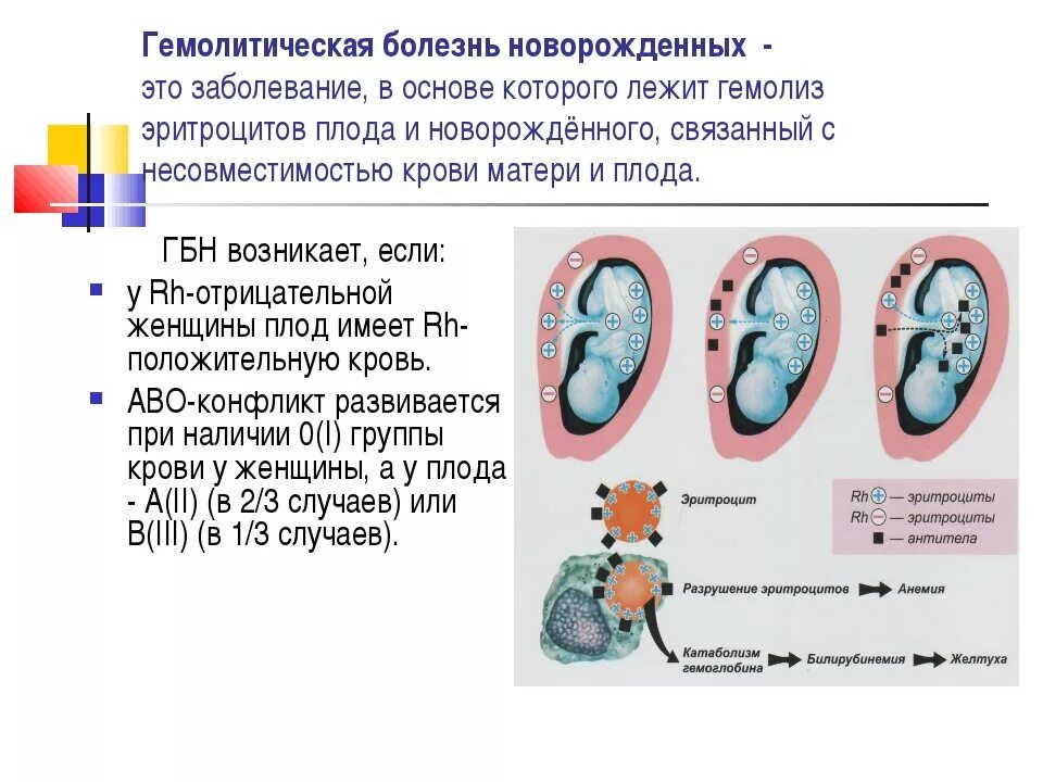 Резус конфликт гемолитическая болезнь новорожденных. Причины развития гемолитической болезни новорожденных (ГБН)?. Гемолитическая болезнь новорожденных по системе rh фактор,. Ведущий метод диагностики гемолитической болезни плода:. Резус плода анализ