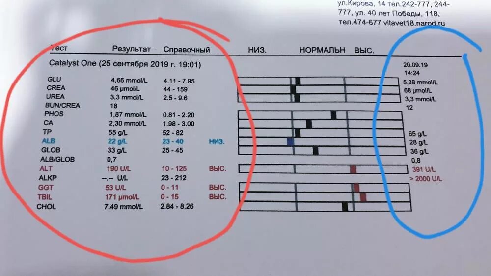 Анализ крови при подагре показатели. Анализ мочи при подагре показатели. Биохимический анализ крови при подагре показатели. Показатели крови при подагре у женщин.