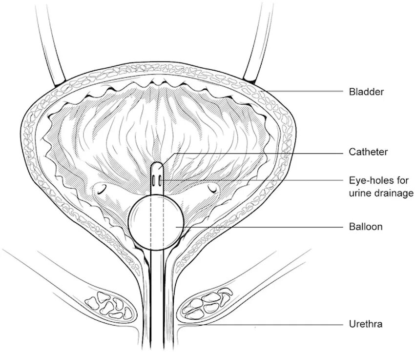 Схема строения мочевого пузыря. Мочевой пузырь анатомия у мужчин. Мочевой пузырь уретра и предстательная железа. Мочевой пузырь Хема. Уретра предстательной железы