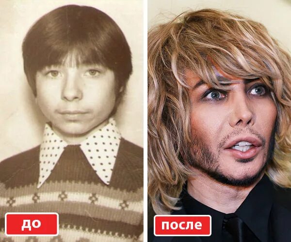 Не отстают от звёздных женщин: пять знаменитых мужчин, переборщивщих с пластикой