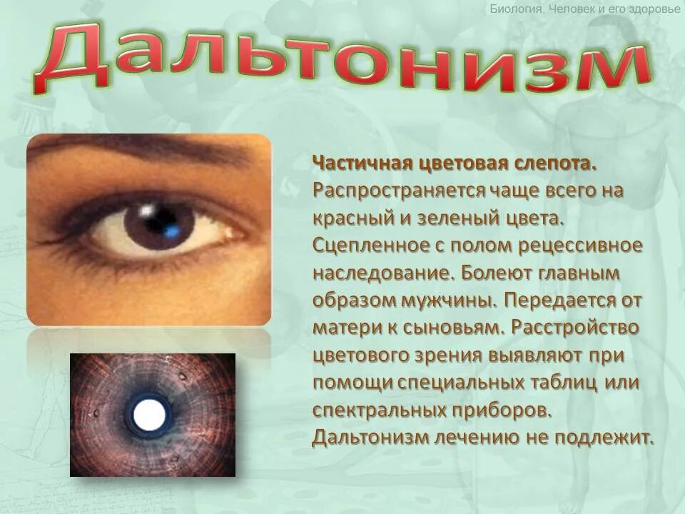 Заболевание куриная слепота витамины. Заболевание глаз с описанием. Частичная потеря зрения.