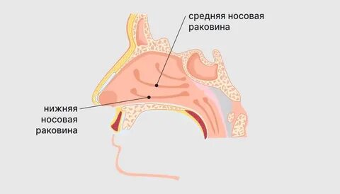 Заложен нос текут сопли что делать