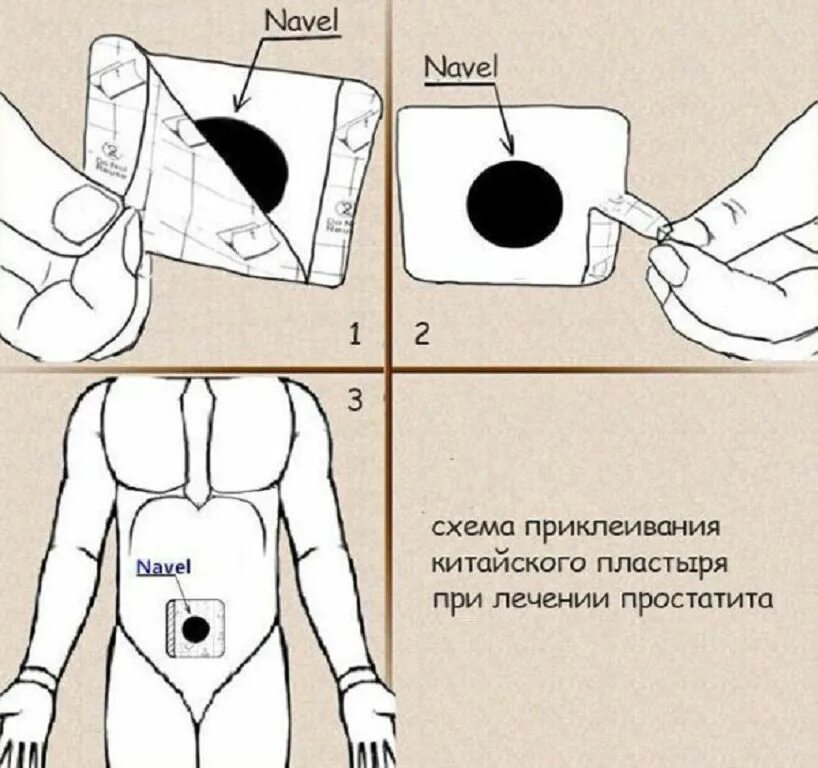 Перцовыйпластврь при насморке. Перцовый пластырь для спины. Трансдермальный пластырь технологическая схема производства. Пластырь на переносицу от насморка. Схема строения трансдермальных транспортных систем.