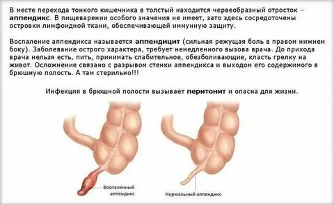 Температура после удаления аппендицита сколько