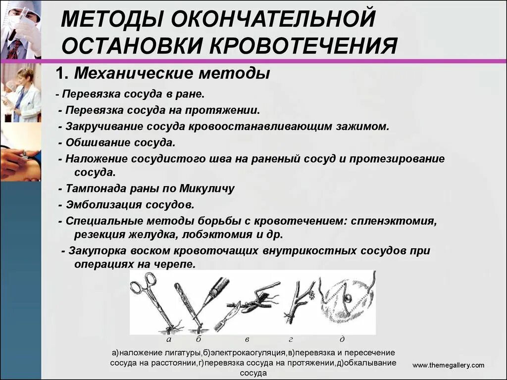 Методы окончательной остановки артериального кровотечения. Инструменты для остановки кровотечения в ране. Механические методы окончательной остановки кровотечения. Метод окончательной остановки артериального кровотечения:.