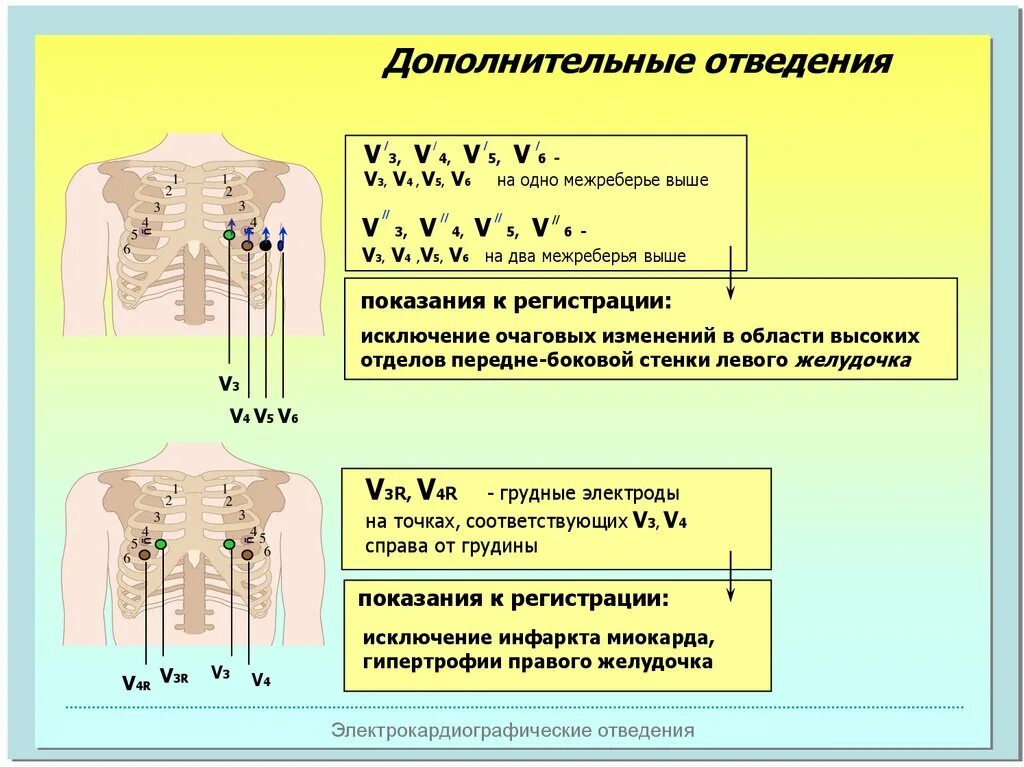 Электроды v7 v8 v9. Электроды ЭКГ отдведение7. ЭКГ отведения v7-v9. Отведения v1-v6 на ЭКГ. Правые грудные отведения