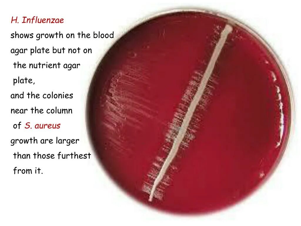 Haemophilus influenzae в носу. Haemophilus influenzae микробиология. Гемофильная палочка микробиология. Haemophilus haemolyticus в норме.