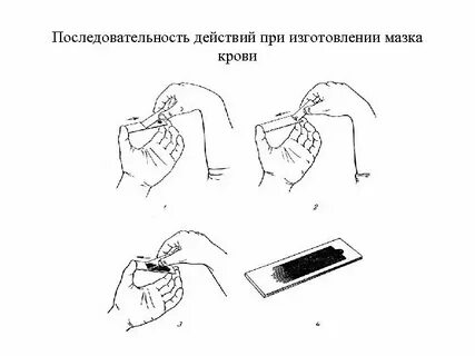 Метод толстого мазка