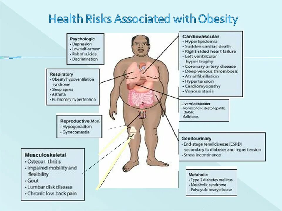 Obesity diseases. Obesity презентация. Illness obesity. Obesity diseases. Ожирение.